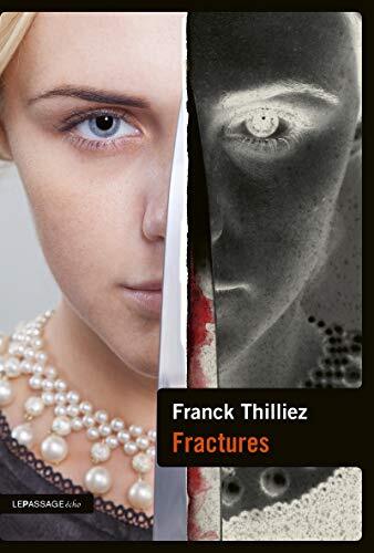 fractures